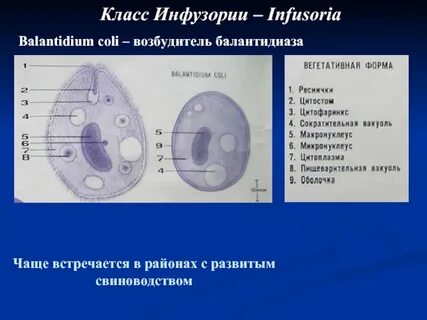 Инфузория балантидий