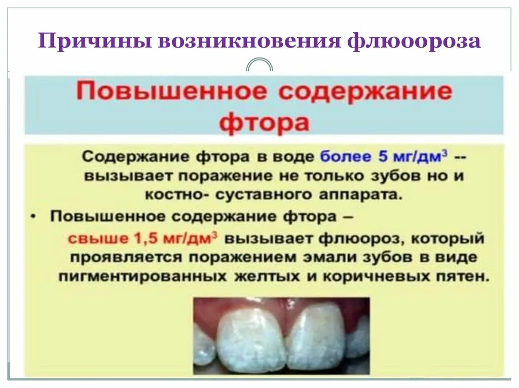Влияние фторид-Иона на эмаль зубов. Влияние фтора на эмаль зубов.