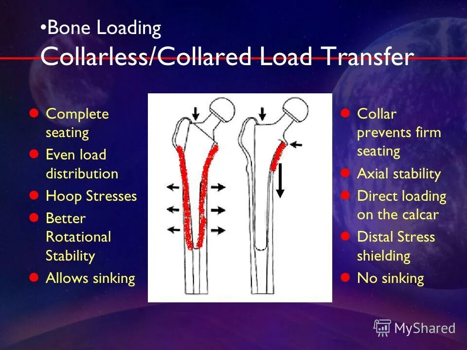 Direct load. Direct load. Tie beam. Испытательная машина ats 2330. Direct download.