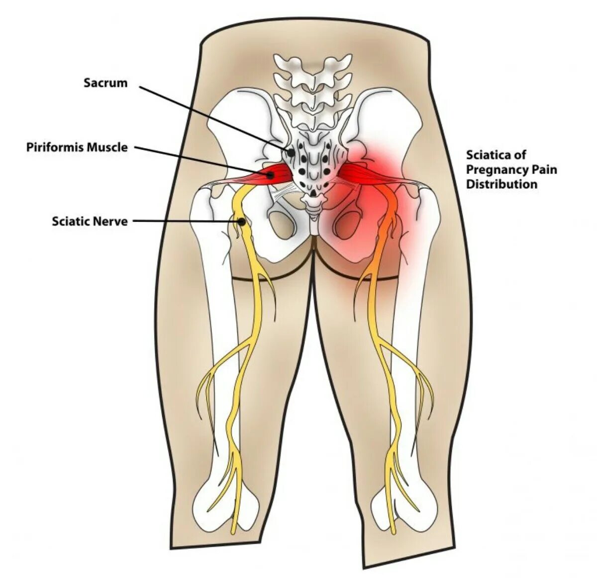 Седалищный нерв анатомия. Седалищный нерв (sciatic nerve)? 011. Мышцы ягодиц анатомия седалищный нерв. Седалищный нерв анатомия схема.