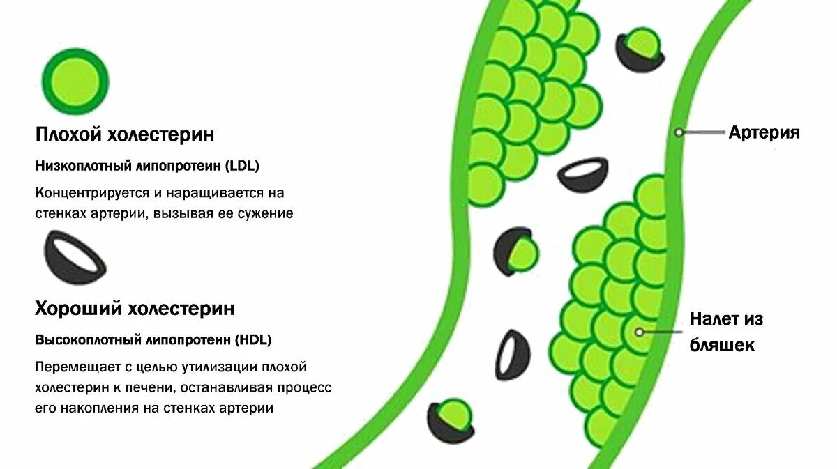 Липопротеид повышен у мужчин. Плохой холестерин. Хороший холестерин. Хороший и плохой холестерол. Что такое хороший холестерин и плохой холестерин.