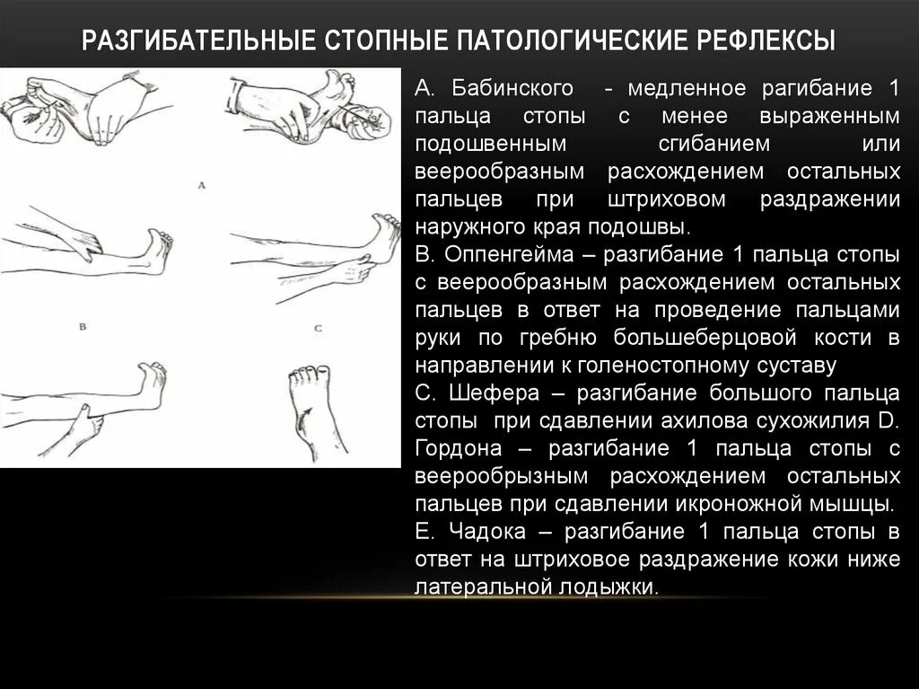 Патологические рефлексы Бабинского Россолимо Гордона. Рефлексы Бабинского Оппенгейма Гордона Шеффера Россолимо Жуковского. Рефлекс Бабинского Оппенгейма Гордона. Рефлексы (Оппенгейма, Шеффера, Бабинского, Россолимо, Гордона.