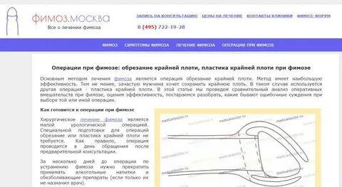 Парафимоз у мужчин