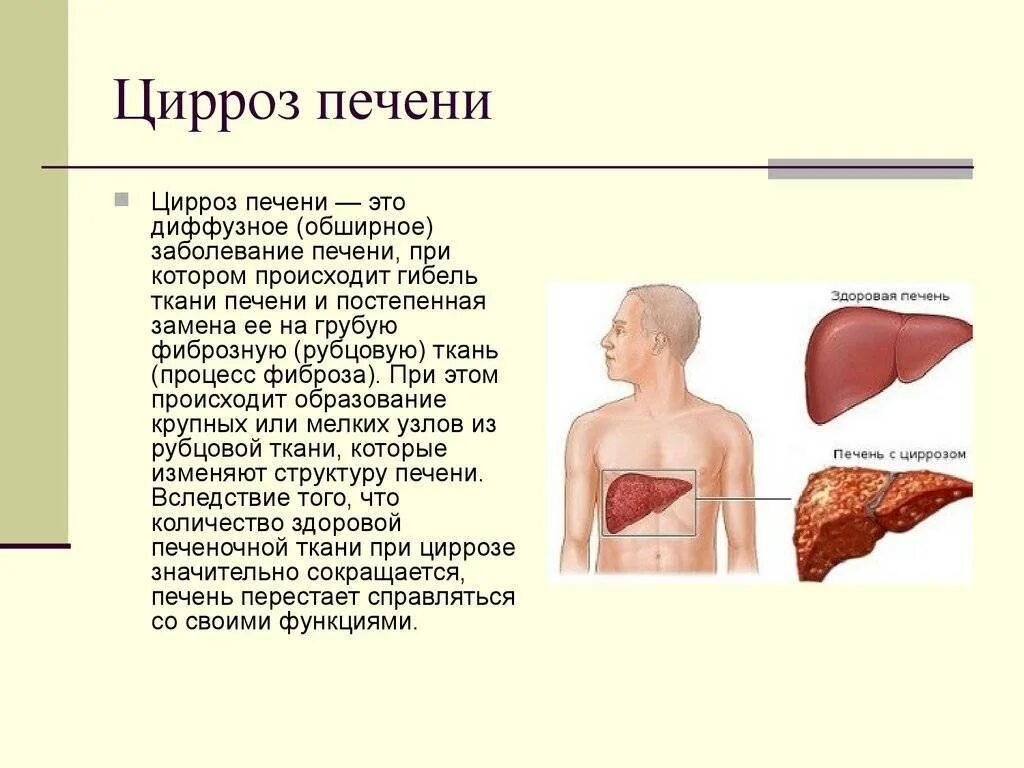 Что такое от в