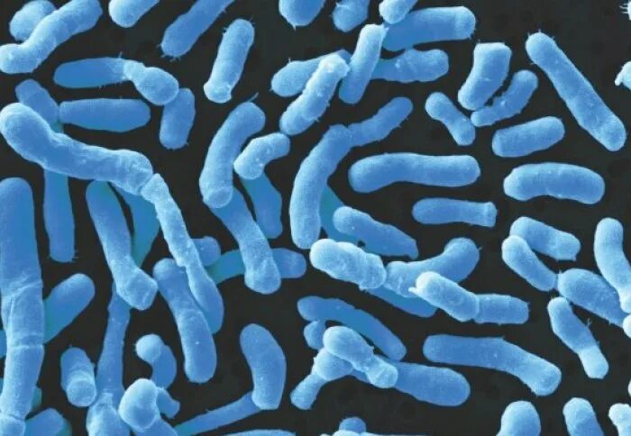 Палочка бифидобактерии. Бифидо и лактобактерии под микроскопом. Bifidobacterium bifidum. Мезофильные молочнокислые бактерии. Ацидофильные лактобактерии (Lactobacillus Acidophilus).