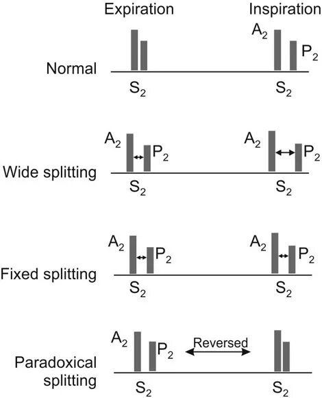 Как выполняется элемент split s. S2 split это. сплит фикс. wide fixed splitting s2.