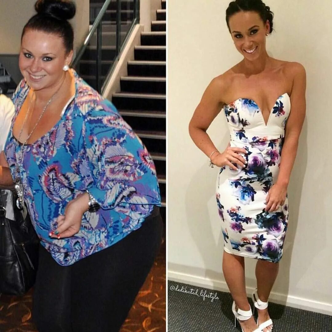 Похудение до и после. Преображение до и после похудения. Похудевшая женщина. До и после похудения женщины.