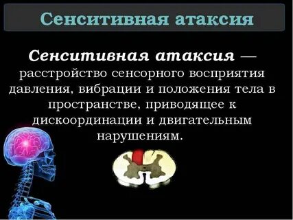Атаксия это