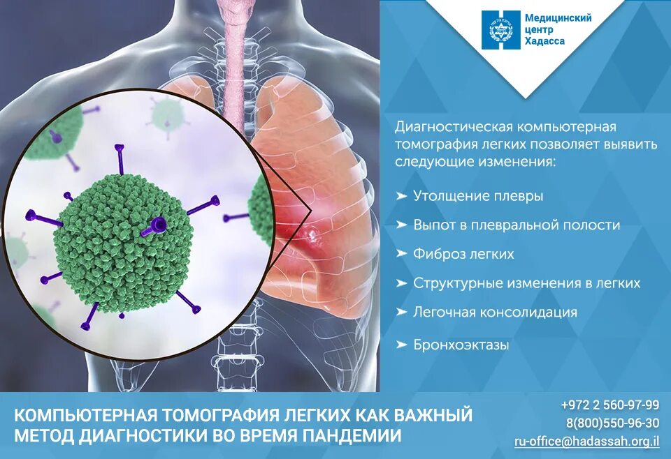 Лечение легких после коронавируса. Легкие на кт при коронавирусе. Кт легких больного коронавирусом. Поражение легких при коронавирусе.