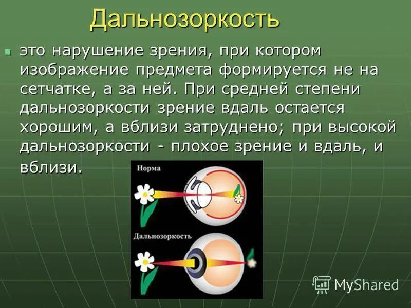 Какое зрение при дальнозоркости. Дальнозоркость. Зрение дальнозоркость. Нарушение зрения дальнозоркость. Дальнозоркость развивается при.