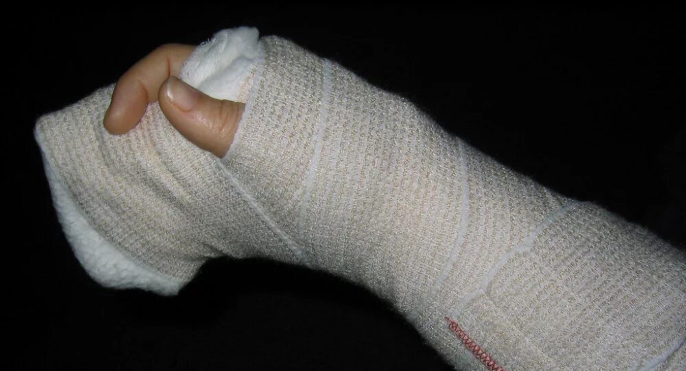 перевязка мизинца на ноге при переломе. перелом лодыжки лангетка. гпс при пеломе мезинца ноги. перелом пальца какой гипс. перелом пальца какой гипс.