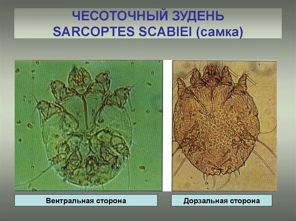 Sarcoptes scabiei морфология. Присоски чесоточного зудня. Чесоточный зудень систематика. Чесоточный зудень систематика. Схема строения чесоточного зудня.