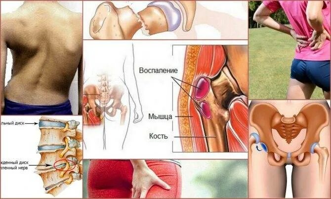 После бега болят колени что делать. Боль в бедренном суставе. Тазобедренный сустав болит. Мышцы тазобедренного сустава болят.