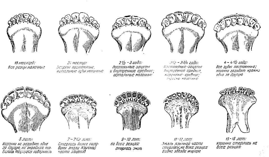 Возраст крупного рогатого скота по зубам. Определение возраста КРС по зубам. Определение возраста крупного рогатого скота. Определение возраста теленка по зубам.