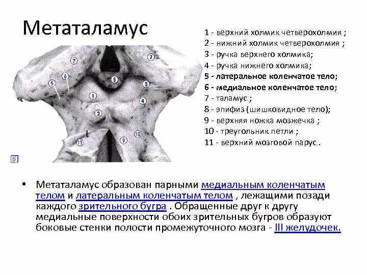 Коленчатые тела мозга. Ядра верхних Бугров четверохолмия. Верхний холмик четверохолмия мозга. Метаталамус коленчатые тела. Метаталамус топография.