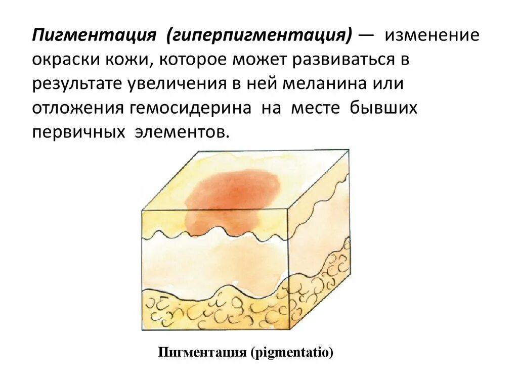 Вторичные элементы поражения