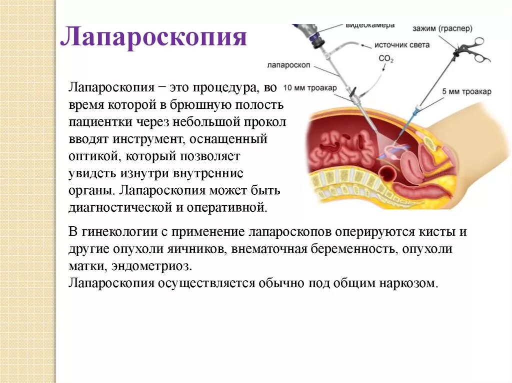 Инструментальное исследование в гинекологии. Инструментальные методы исследования в гинекологии. Инструментальные методы исследования в акушерстве. Перечислите методы исследования в гинекологии.