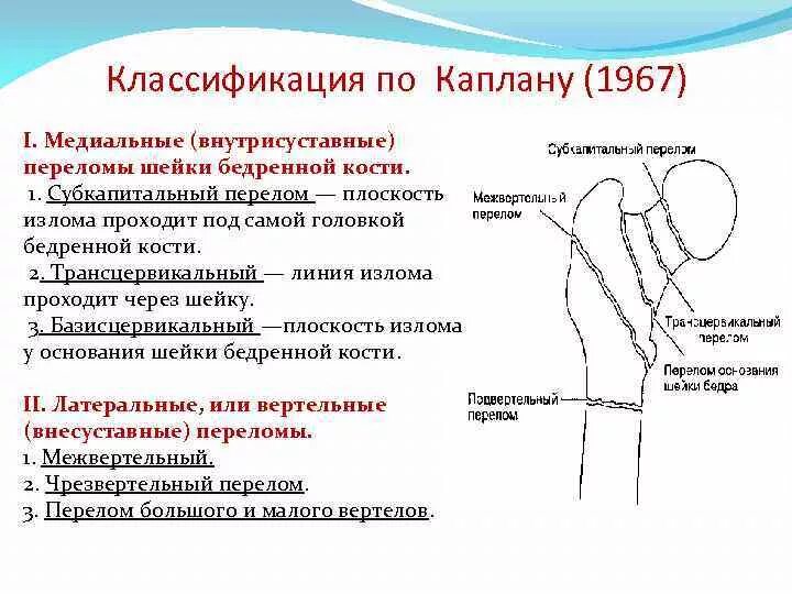 Переломы шейки(медиальные) бедренной кости. Классификация. Классификация переломов шейки бедренной кости. Перелом шейки бедра классификация субкапитальный. Проксимальные переломы бедренной кости классификация. Контрактура сустава код по мкб 10