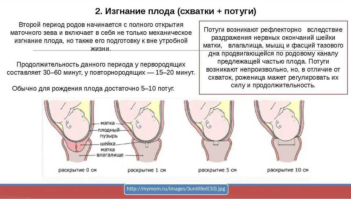 Может ли шейка матки раскрыться. Период изгнания второй период родов. 2 период родов изгнание плода. фазы периода раскрытия шейки матки.