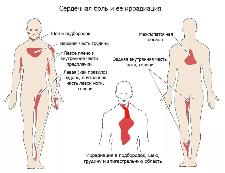 Слабая ноющая боль. Болит в области сердца. Отдает в область сердца. Резкая боль в области сердца. Локализация боли в сердце.