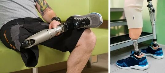 Протезы нижний тагил. Модульный протез бедра пн6-э. Модульный протез 3w710-100. 3. Протезы нижний тагил.