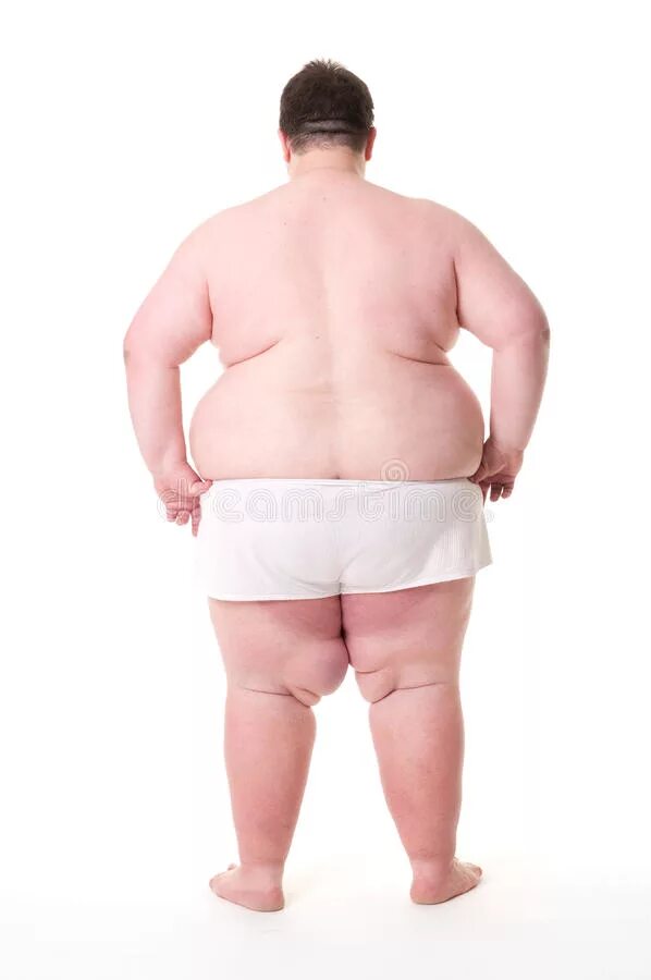 Люди с толстыми ногами. Ноги полных людей. Люди с лишним весом на улице. Ноги полных людей. Полные икры.