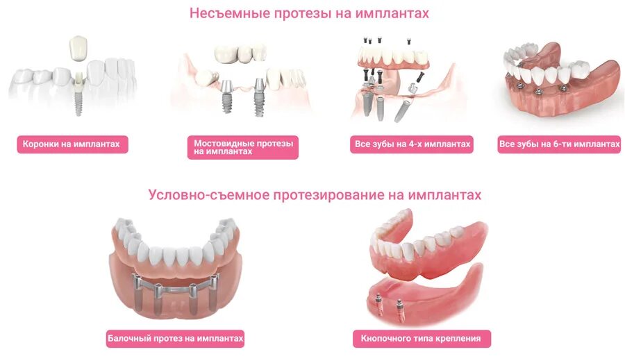 Съемные и несъемные протезы классификация. Классификация полных съемных протезов. Съемный зубной протез а 2. Классификация несъемных протезов ортопедическая стоматология. Ортопедический этап лечения