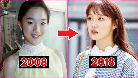 Lee sung kyung plastic cheap surgery