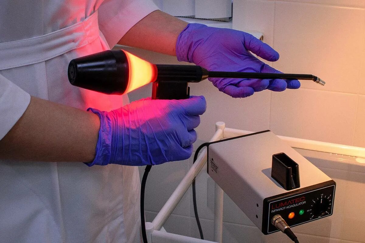 Эксимерный лазер в офтальмологии. Лазерная коррекция зрения femto lasik. Лечение после лазера. Лечение после лазера. Сосудистые звездочки розацеа.