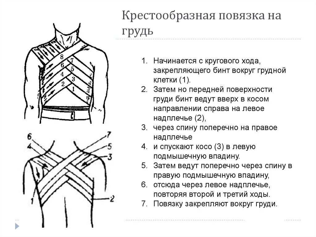 Повязка на грудную клетку алгоритм. Крестообразная повязка на грудную клетку показания. Крестообразная повязка на грудную клетку алгоритм. Перевязка крестообразная на грудную клетку. Наложение бинтовой повязки на грудную клетку.