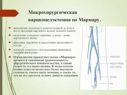 Восстановление после мармара