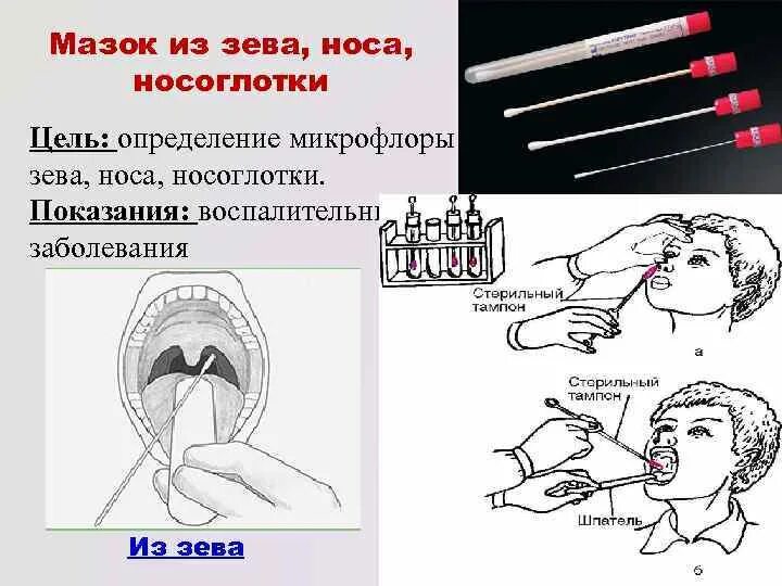 Мазок из зева манипуляция. Лабораторная посуда для взятия мазка из зева и носа. техника взятия мазка из зева и носа на пцр. алгоритм взятия мазков с зева и носа. забор мазка на коронавирус схема.