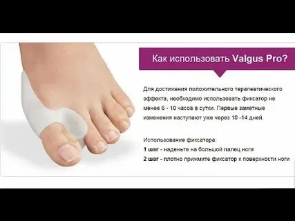Лечение косточки без операции
