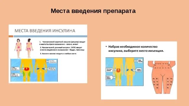 Мечта введения инсулина. Места для инъекций инсулина длительного действия. Места введения инсулина. Мечта выкдения инсулина. Мечта введения инсулина.