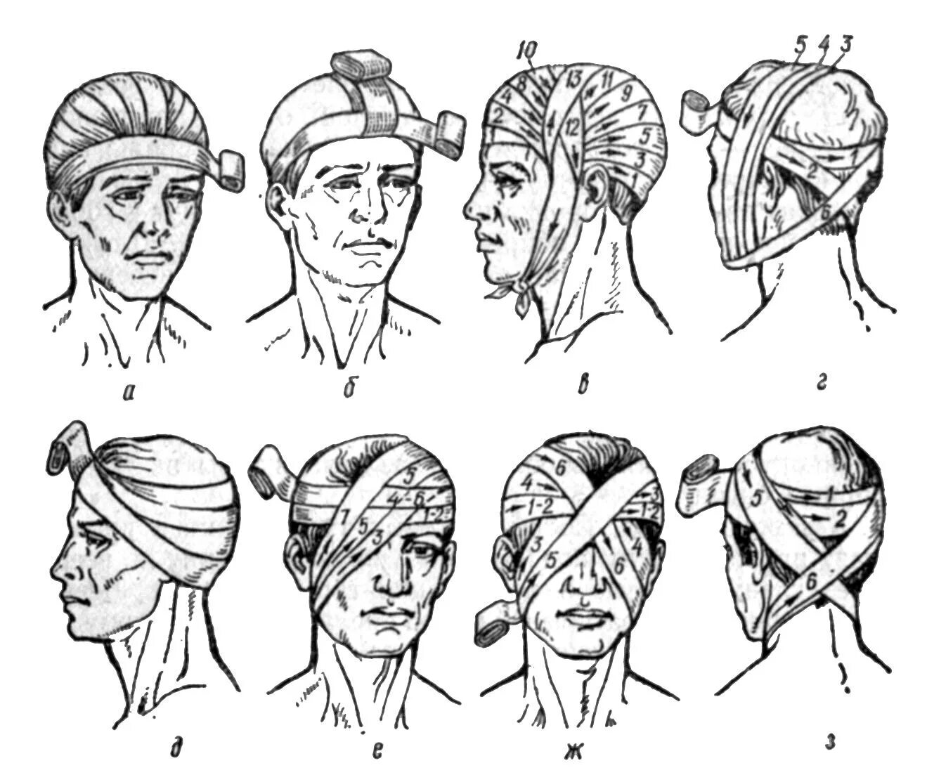 Повреждение затылка какая повязка. Бинтование головы чепец. Десмургия чепец техника. Перевязка головы бинтом чепец. Повязки десмургия хирургия.