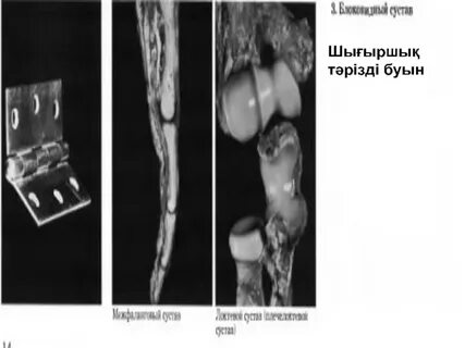 Бір тесікте үш әтешпен жыныстық қатынас