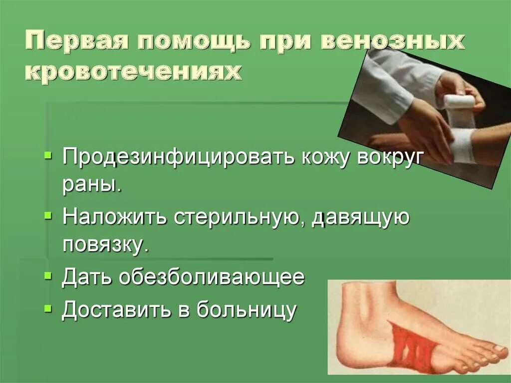 Первая помощь при венозном кровотечении. Оказание первой помощи при венозном кровотечении. Памятка оказание первой помощи при венозном кровотечении. Оказание первой помощи при венозном кровотечении по пунктам.