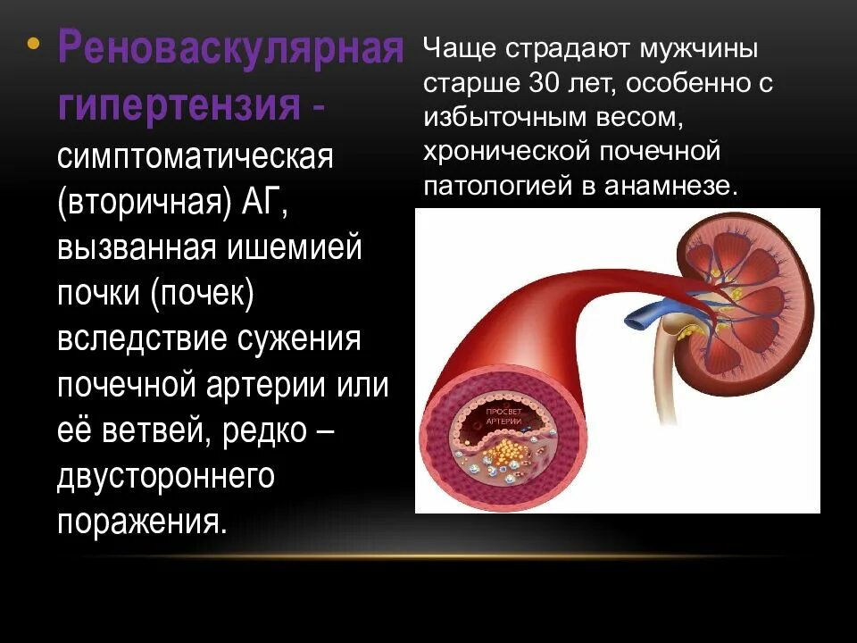 Почечная гипертония