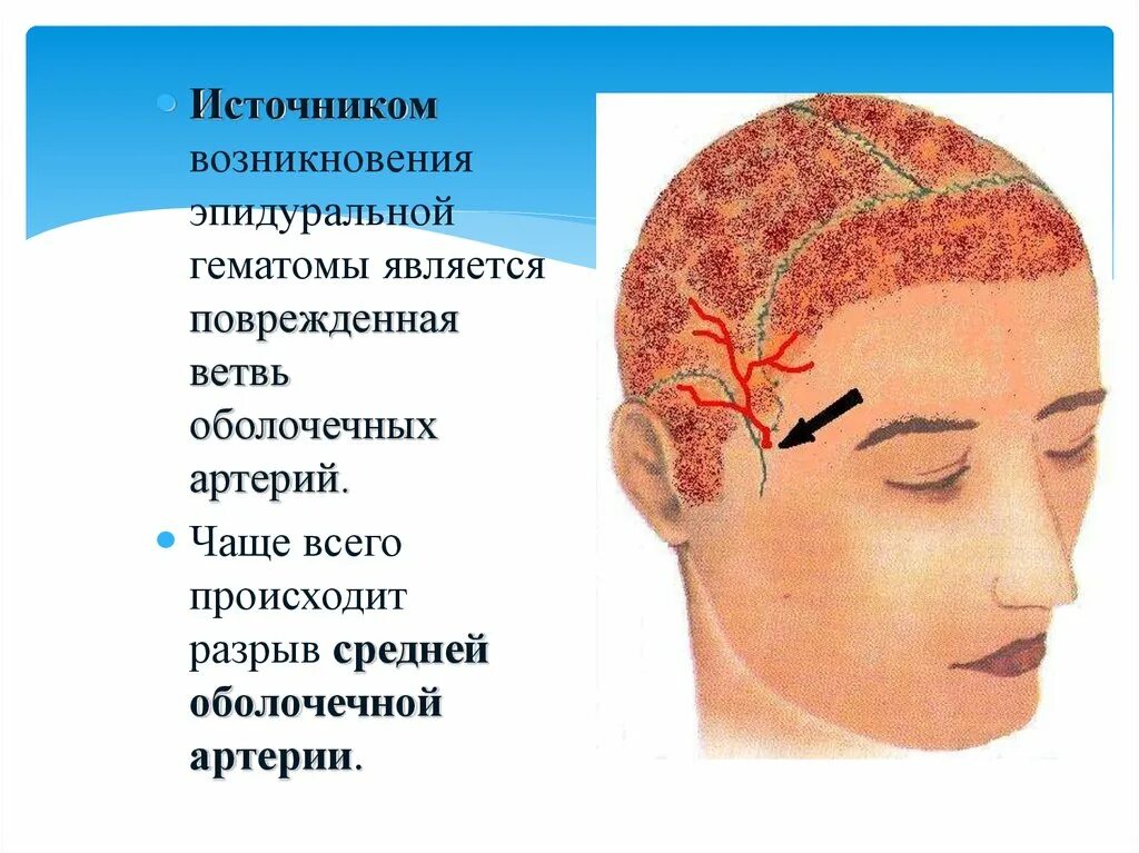 Зчмт сотрясение головного. Классификация черепно-мозговой травмы. Черепно-мозговая травма. Открытая черепно-мозговая травма классификация. Открытые и закрытые черепно мозговые травмы.