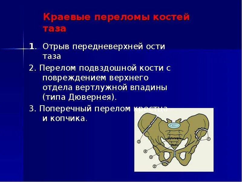 Разрыв крестцов. Краевой перелом крыла левой подвздошной кости. Подвздошная кость рентген анатомия. Краевой перелом подвздошной кости. Трабекулярный перелом крестца.