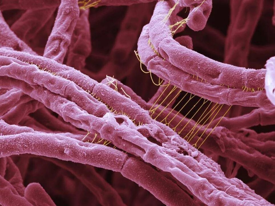 Бацилла сибирской язвы. Бацилла антрацис сибирская язва. Бацилла сибирской язвы. Bacillus anthracis микробиология. Бацилла сибирской язвы.