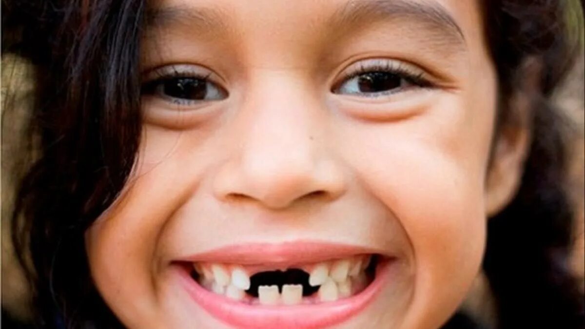4 года зубы выпадают. Красивые детские зубы.
