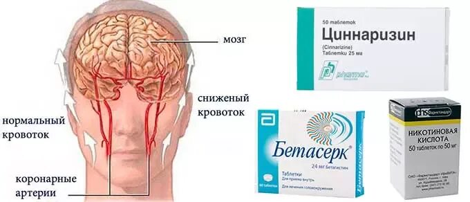 Таблетки для сосудов мозга. Сосуда расширяющие таблетки. Таблетки от сосудов головного мозга. Лекарство для сосудов головного мозга. Препараты для расширения сосудов головы.