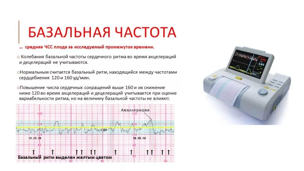 Можно почувствовать сердцебиение плода. Вариабельность сердечного ритма плода на КТГ. Базальный ритм на КТГ. Базальная частота сердечных сокращений плода. Базальная частота сердцебиения плода КТГ.