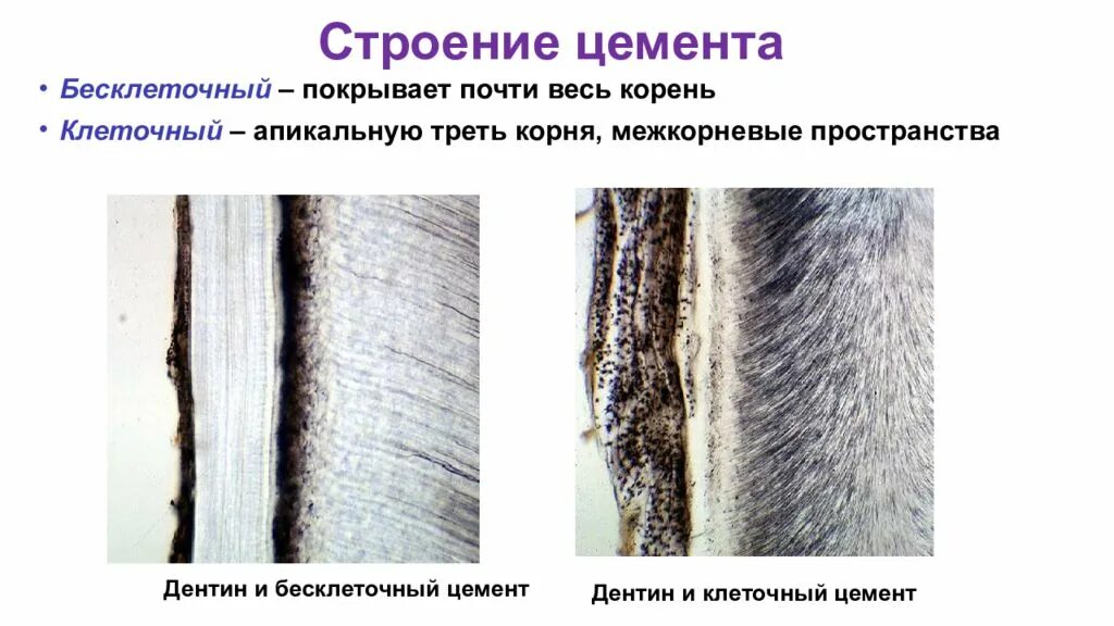 Цемент гистология. Гистологическое строение цемента. строение бесклеточного цемента. цемент корня зуба гистология. строение цемента гистология.