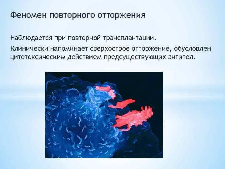 Повторная пересадка. Феномен вторичного отторжения трансплантата. Феномен это. Волчаночноклеточный феномен. Сверхострое отторжение трансплантата.