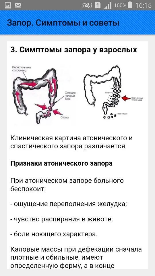 Как работает запор. Запор. симптоматика запора. признаки запора. причины запора.