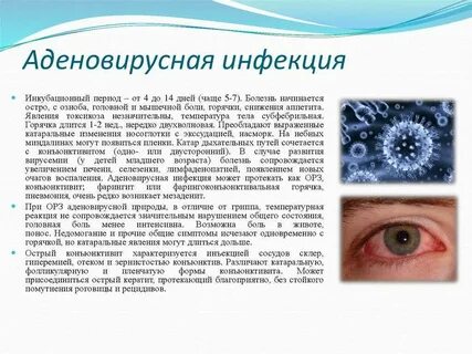 Конъюнктивит воздушно капельным путем