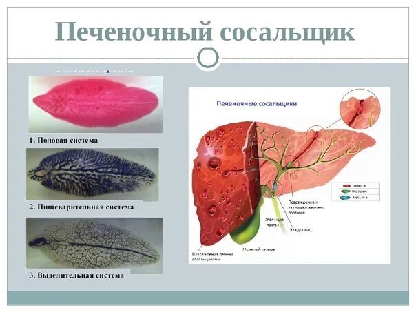 Диагностическая стадия печеночного сосальщика. Строение печеночного сосальщика биология. Строение пищеварительной системы печеночного сосальщика. Печеночный сосальщик название заболевания.