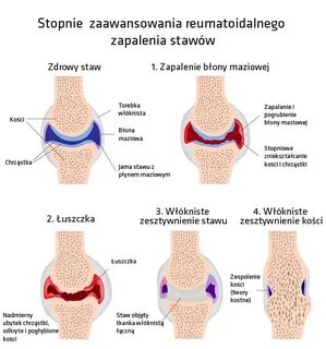 Rzs swsu